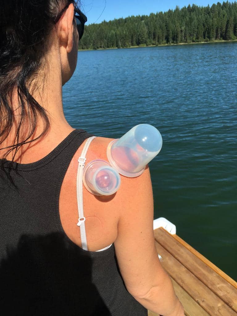 Silicone Cupping Set