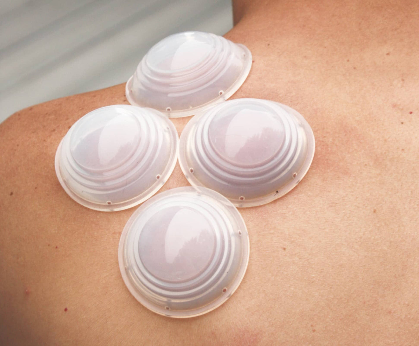 Silicone Cupping for Shoulder Pain