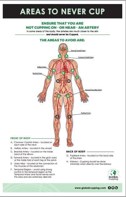 Where not to cup poster