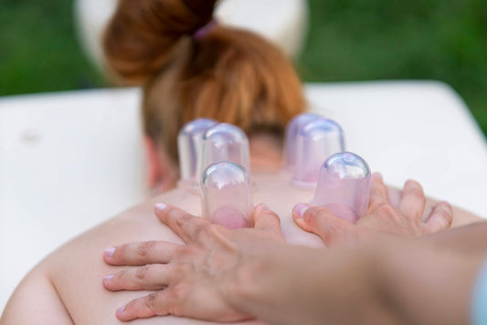 Essential Cupping Therapy Supplies: A Comprehensive Guide