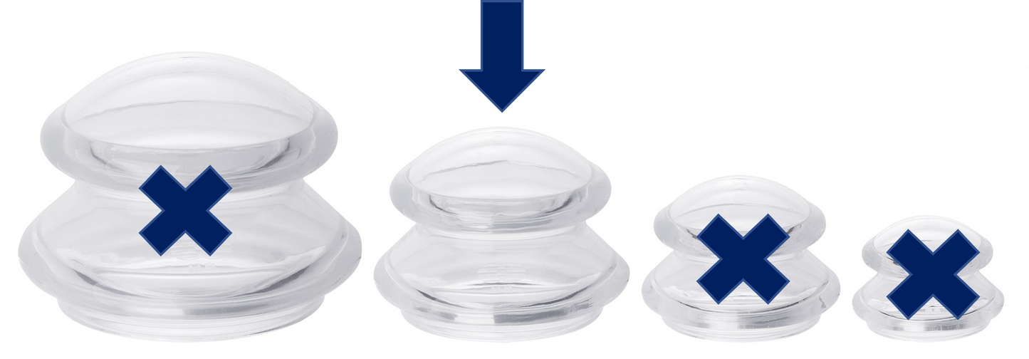 Face and Body Cupping Set